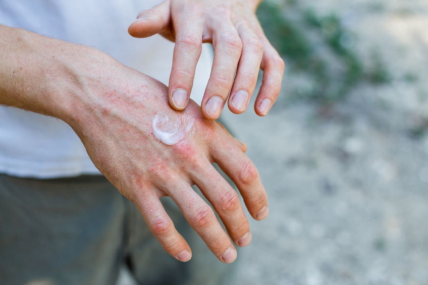 5 Things to Know When Using CBD as a Topical Pain Reliever